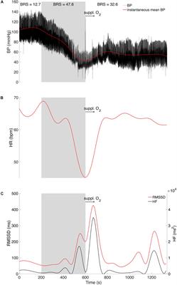 Cardiovascular and Cerebral Responses During a Vasovagal Reaction Without Syncope